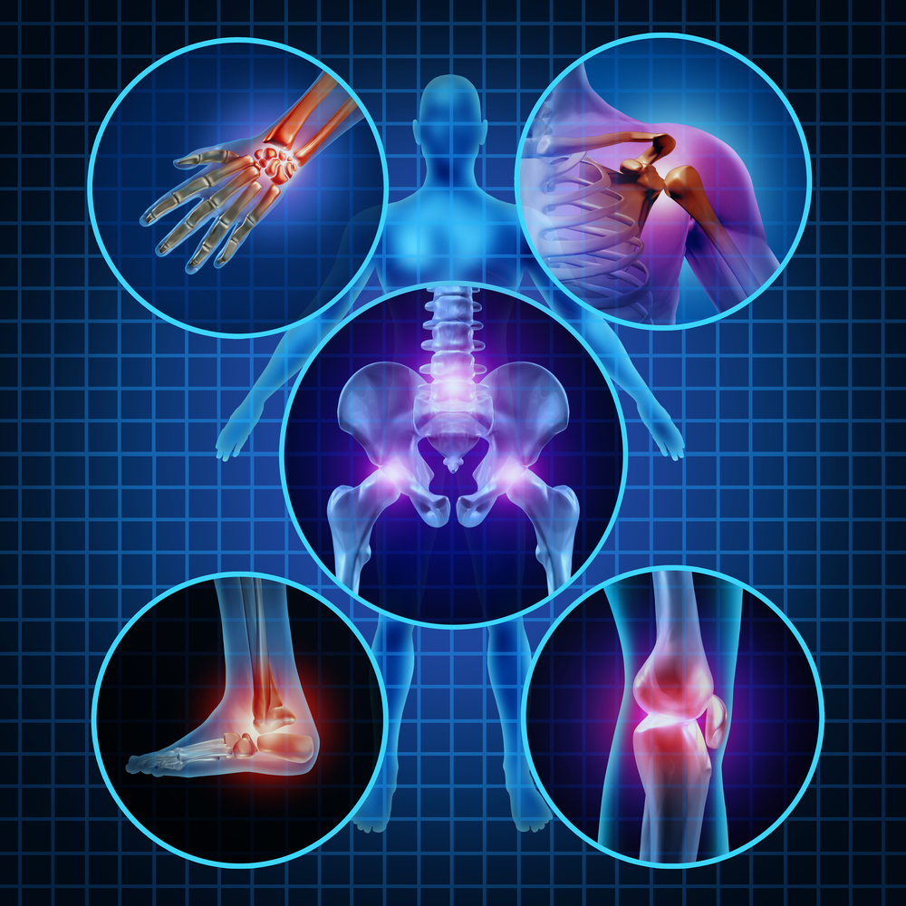 arthritis niche